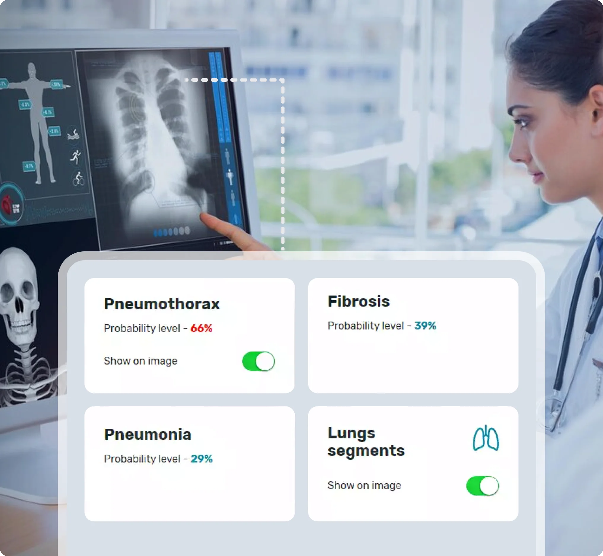 Automated X-Ray Analysis